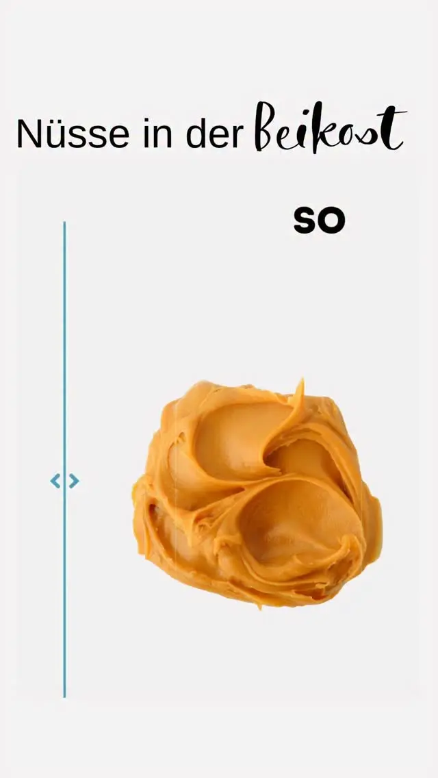 Nüsse sind wertvoll – aber in der Beikostzeit gilt: Vorsicht! 🚫🥜
‌
Viele Eltern sind verunsichert, wenn es um Nüsse geht:
💭 Sind sie erlaubt?
💭 Welche Form ist sicher?
💭 Wann darf mein Baby überhaupt Nüsse essen?
‌
Hier kommt die kurze Antwort:
👉 Ganze Nüsse & harte Nusssplitter sind tabu im 1. Lebensjahr und darüber hinaus – es besteht akute Verschluckungs- & Erstickungsgefahr!
‌
💡 So geht’s richtig:
✅ Verwende fein gemahlene Nüsse (z. B. im Porridge oder Gebäck)
✅ Greife auf 100 % Nussmus (ohne Zucker oder Salz) zurück
✅ Starte mit kleinen Mengen – z. B. 1TL Nussmus im Brei, Joghurt oder als Brotaufstrich
✅ Achte auf Reaktion bei den ersten Gaben

🥜 Ob Mandel, Cashew, Walnuss oder Erdnuss – viele Nüsse liefern wertvolle Fette, Vitamine & Mineralstoffe. Richtig eingesetzt, sind sie eine nährstoffreiche Ergänzung in der Beikost!

📌 Unser Tipp: Starte mit Mandelmus oder Erdnussmus in Bio-Qualität und beobachte gut.
👉 In unserem Beikostkurs erklären wir dir alle wichtigen Basics zur sicheren Lebensmittelauswahl in der Praxis!

Für eine Übersicht aller geeigneten & ungeeigneten Lebensmittel im 1. Jahr:
Kommentiere „📋“ und wir senden dir unsere 3 kostenlosen Listen per DM!

#beikostwissen #beikoststart #breifrei #nussmus #babyernaehrung #breifreibaby